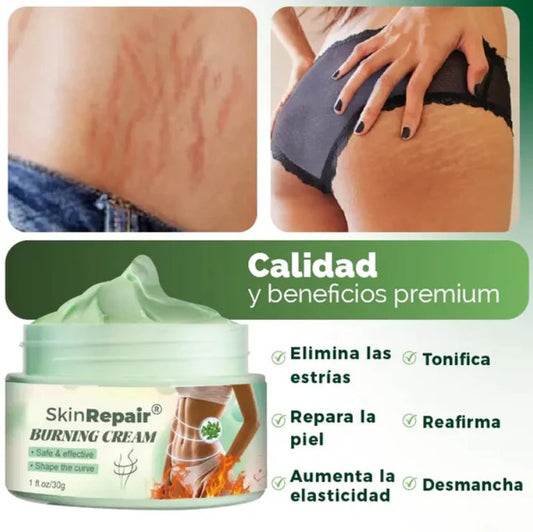 Crema Antiestrías Skinrepair Reafirmante
