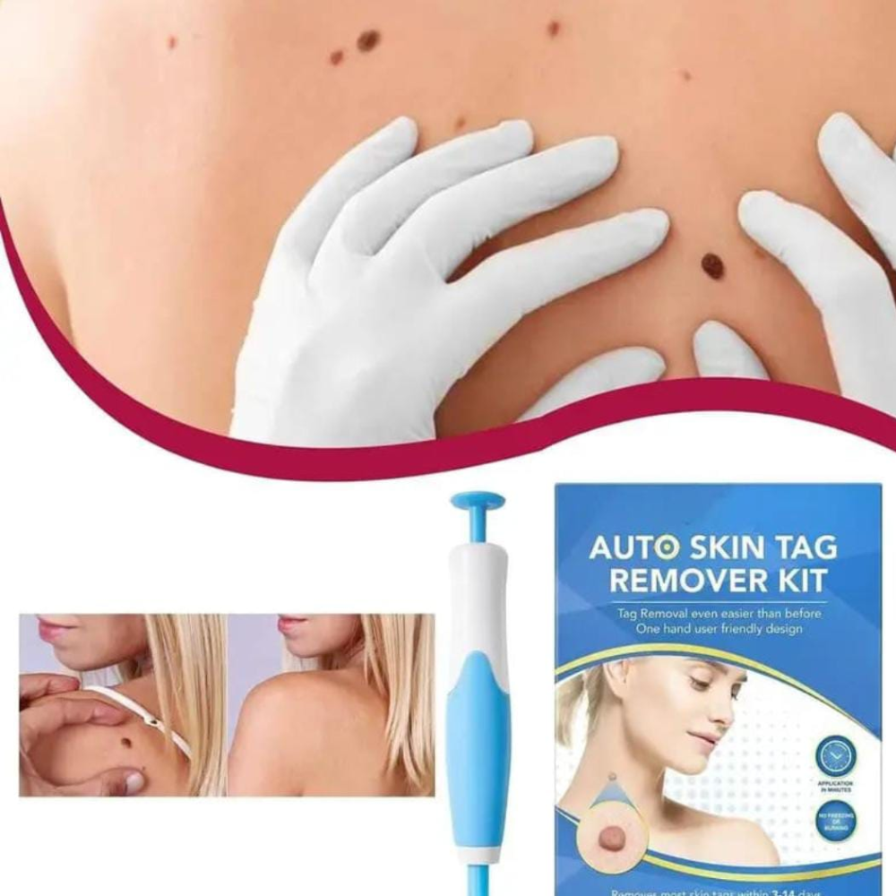 Quita Verrugas Parche Adesivo Resultados Visíveis