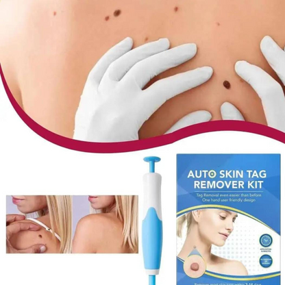 Quita Verrugas Parche Adesivo Resultados Visíveis