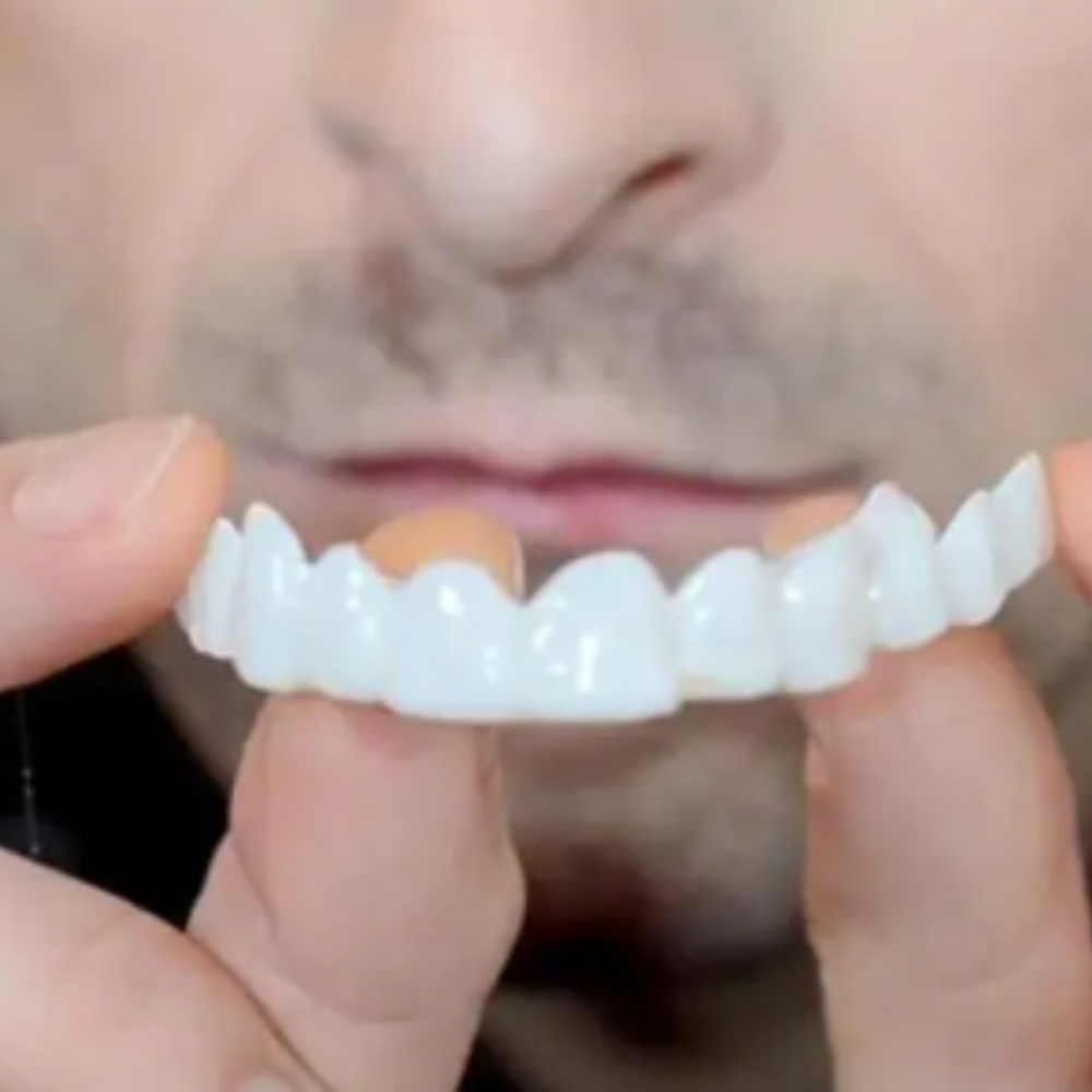 Carillas Dentales Sonrisa Blanca Natural