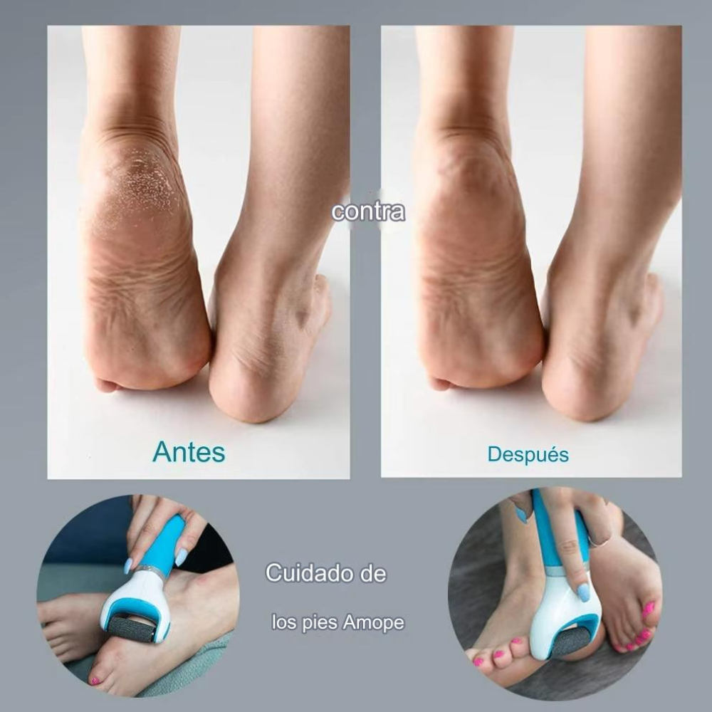 Removedor De Callos Eléctrico Pulidor Pies Exfoliador LIM-1