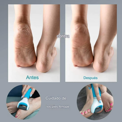Removedor De Callos Eléctrico Pulidor Pies Exfoliador LIM-1
