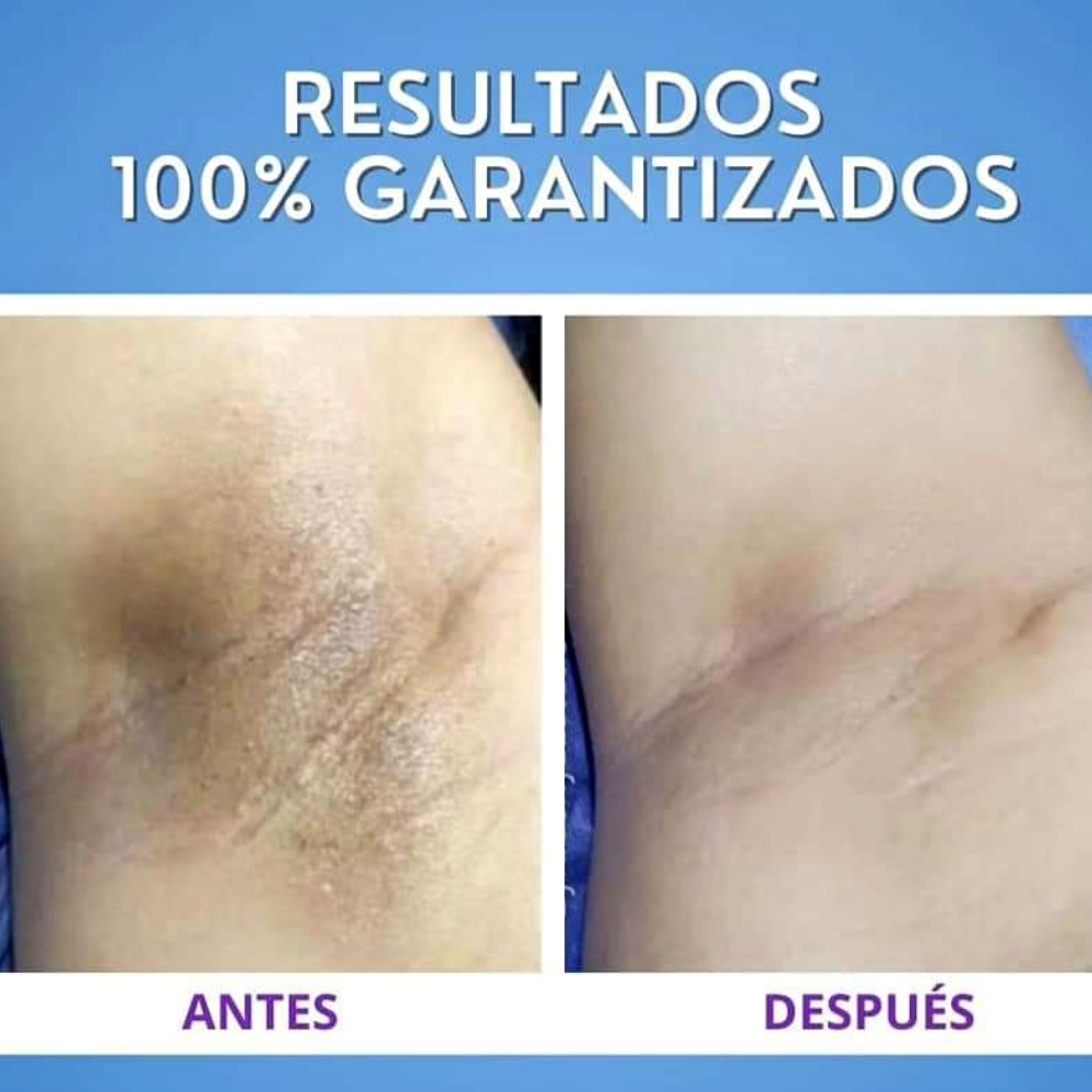 Cremas aclarantes 2 unidades