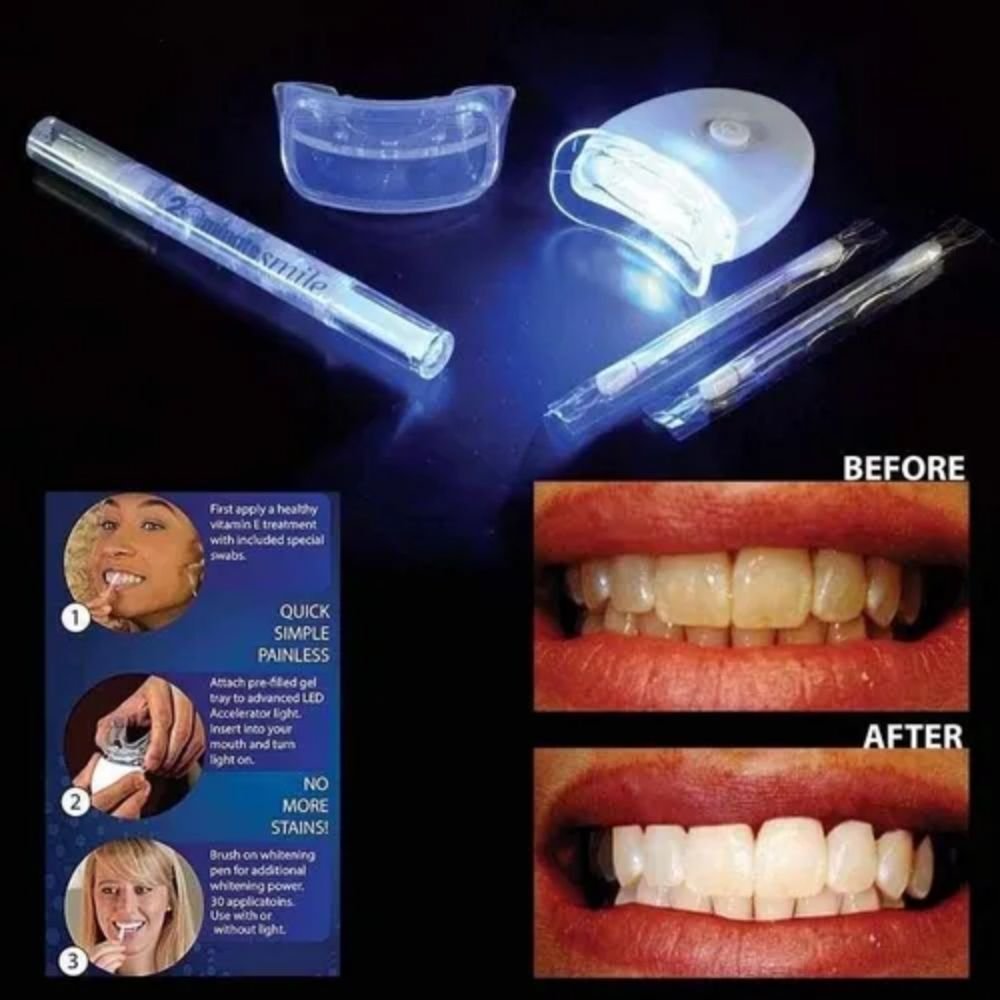 Kit Blanqueamiento Dental Profesional